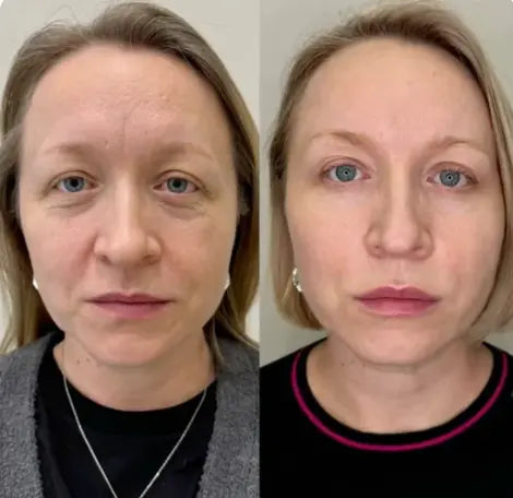 Marie, 47 ans